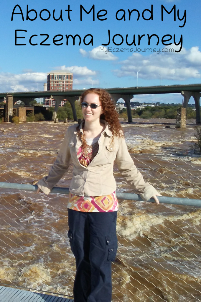 lady standing on bridge over river with text overlay: about me and my eczema journey